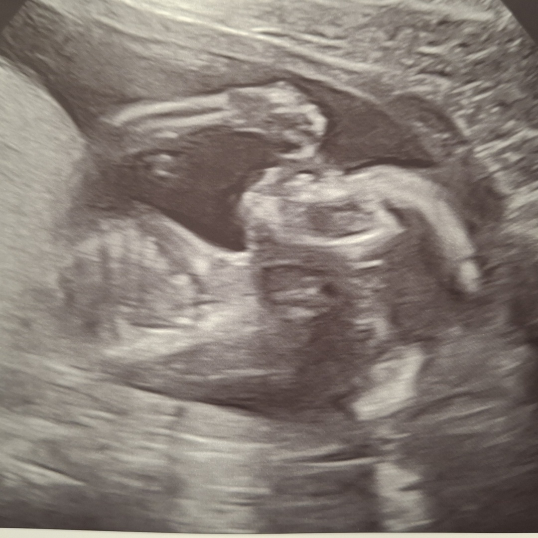 Photo shared by Patrice for their Babylist baby registry.