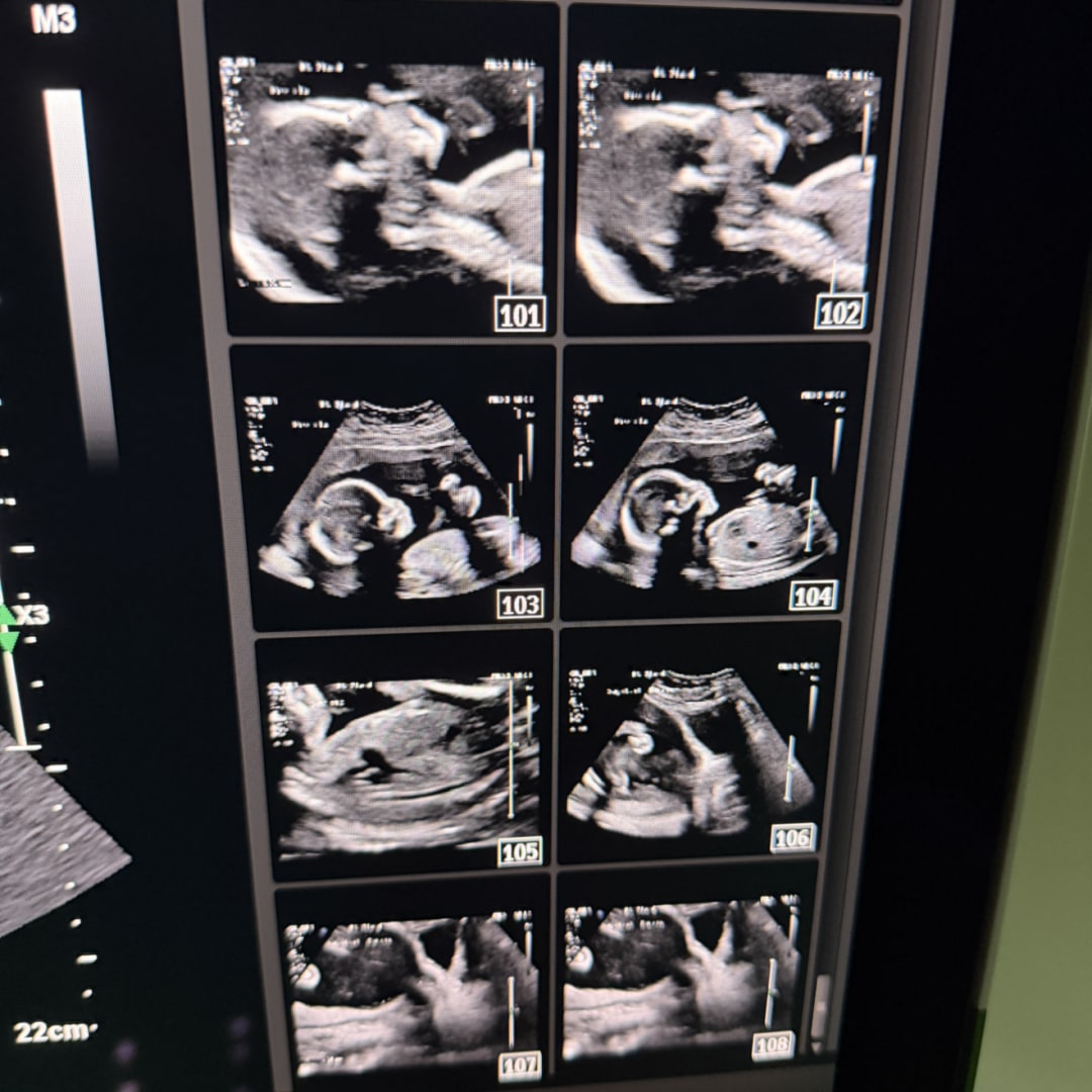 Photo shared by Christina for their Babylist baby registry.