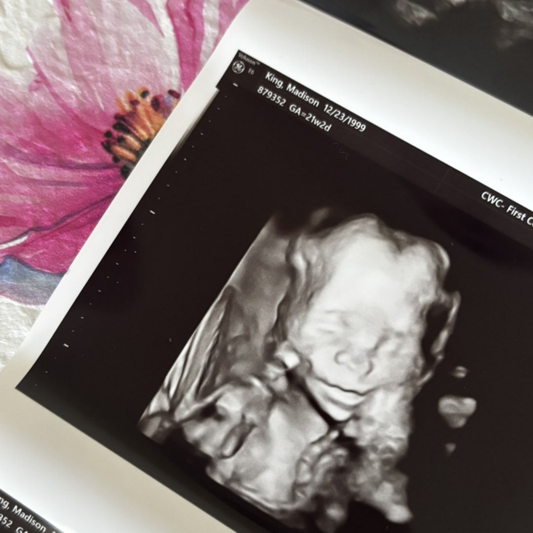 Photo shared by Madison for their Babylist baby registry.