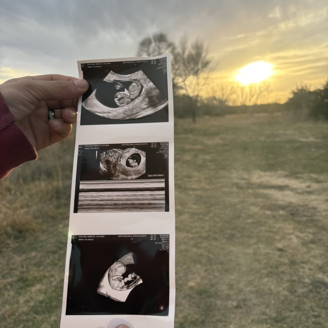 Photo shared by Annelise for their Babylist baby registry.