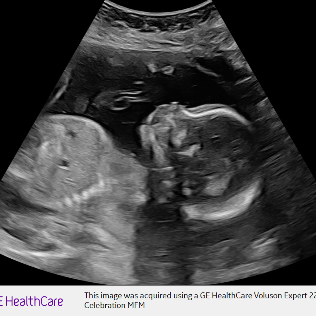 Photo shared by Nicole for their Babylist baby registry.