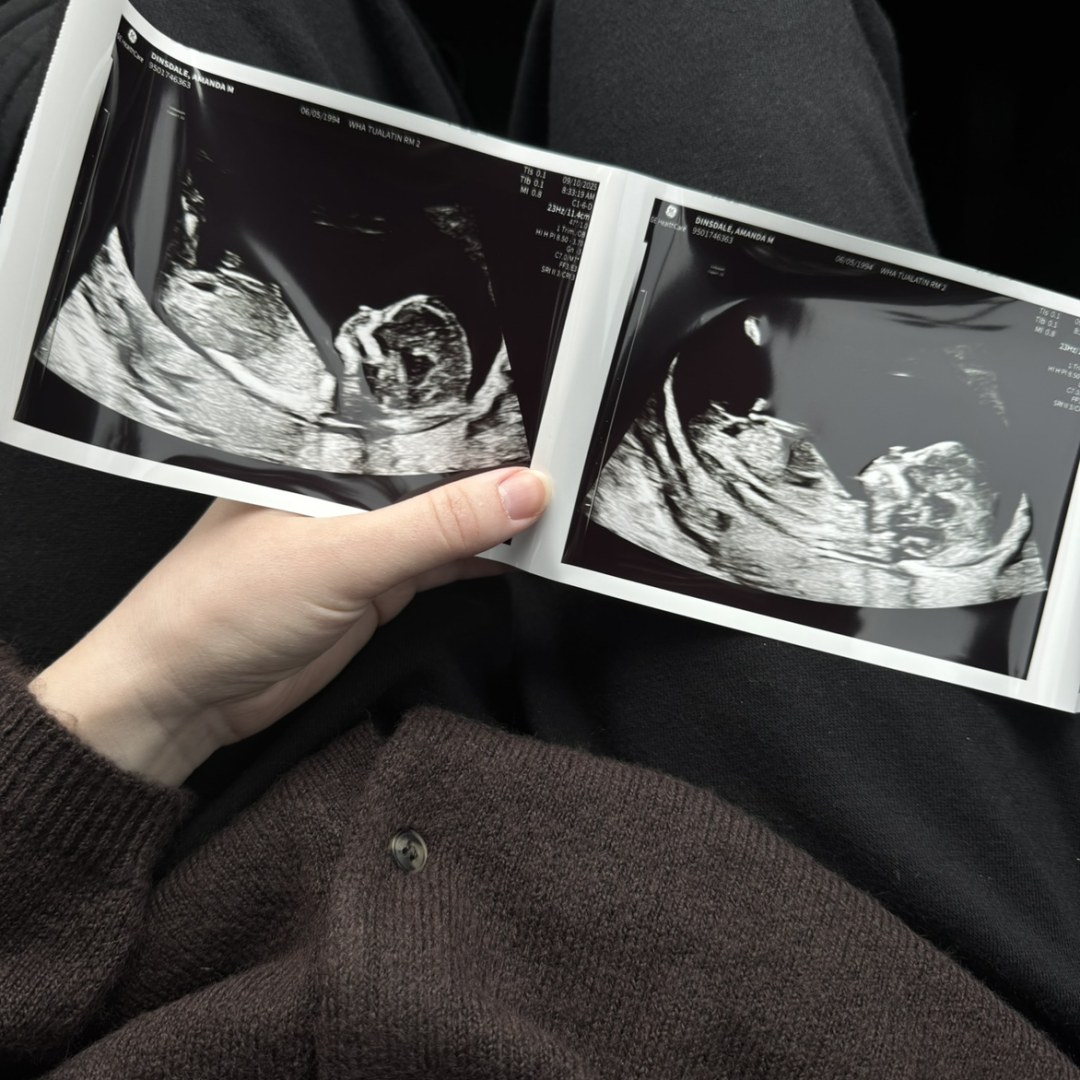 Photo shared by Amanda for their Babylist baby registry.