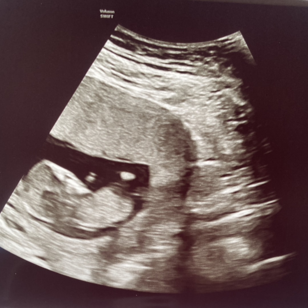 Photo shared by Kayla for their Babylist baby registry.