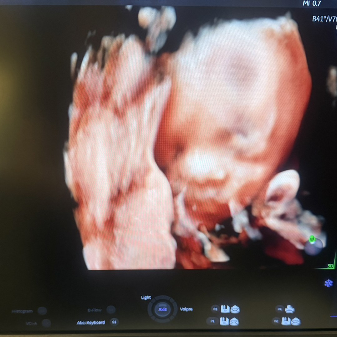 Photo shared by Angelique for their Babylist baby registry.