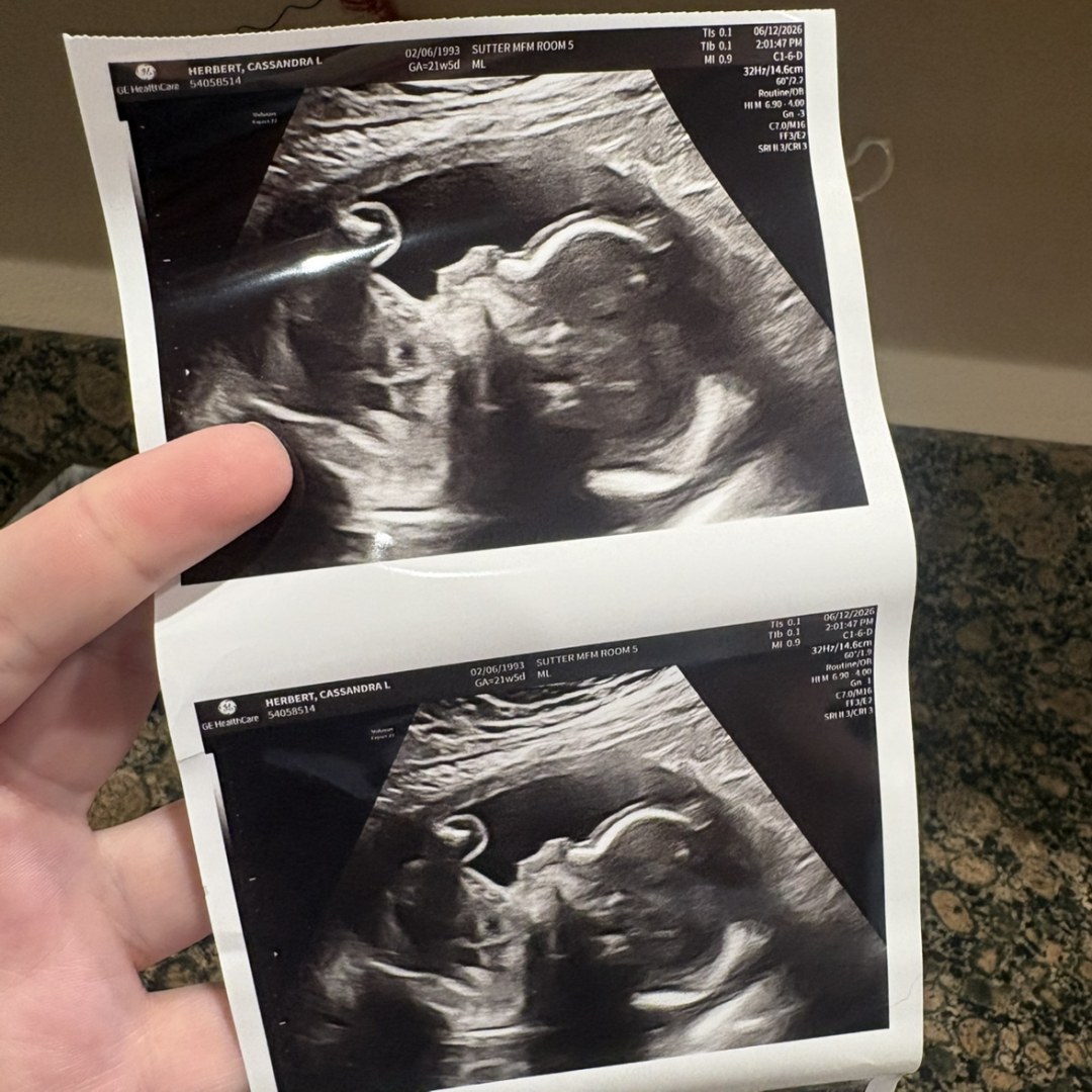 Photo shared by Cassie for their Babylist baby registry.