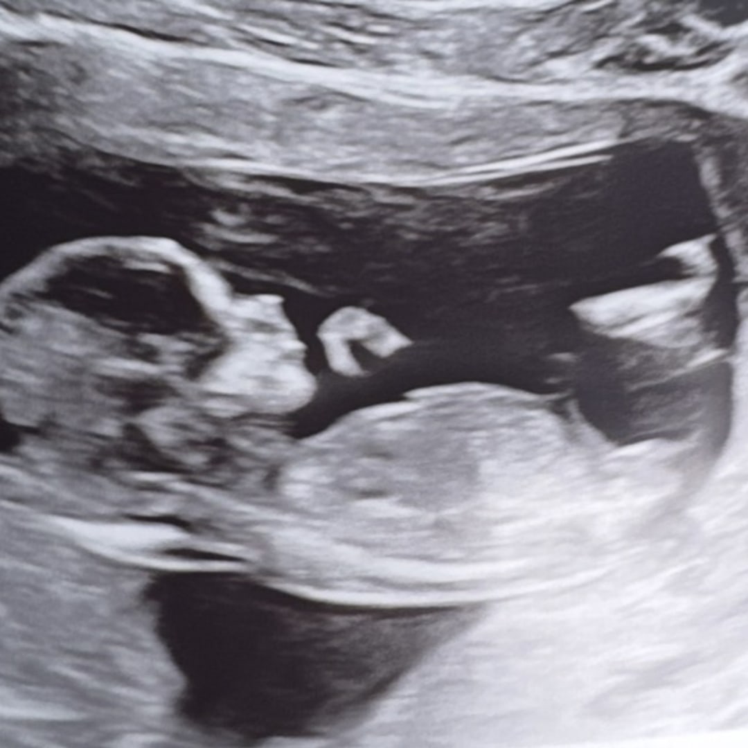Photo shared by Kimberly for their Babylist baby registry.