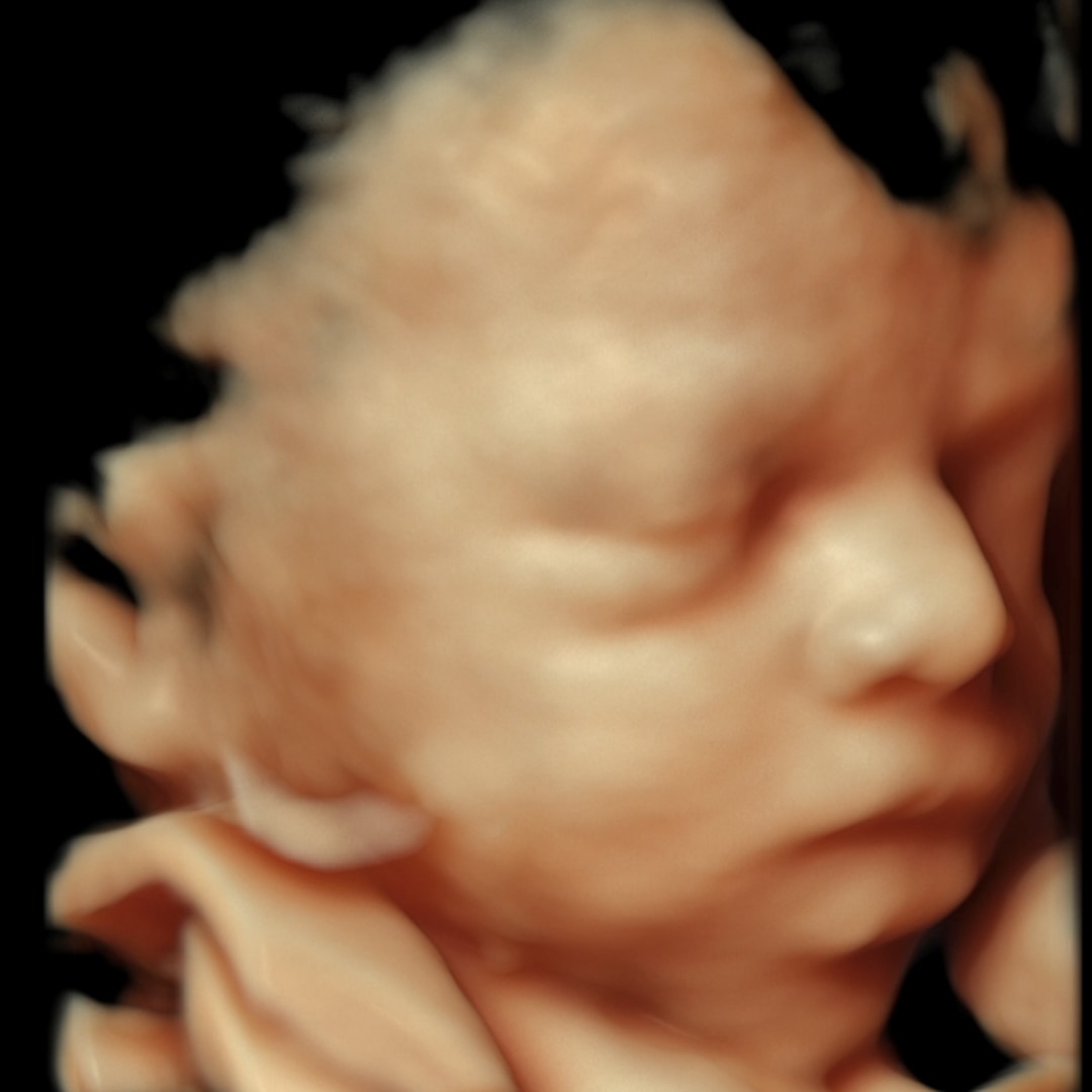 Photo shared by Ileana for their Babylist baby registry.