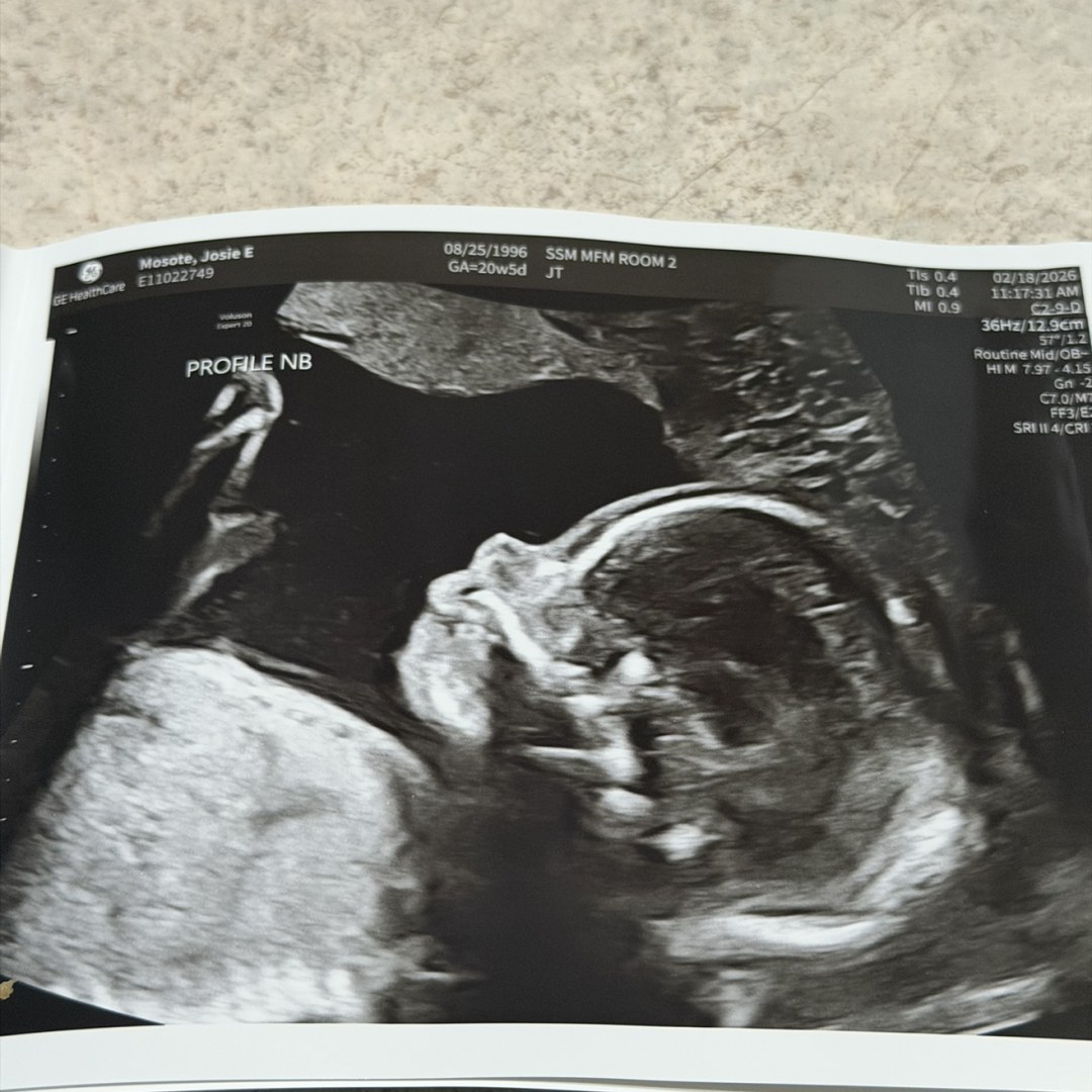 Photo shared by Josie for their Babylist baby registry.