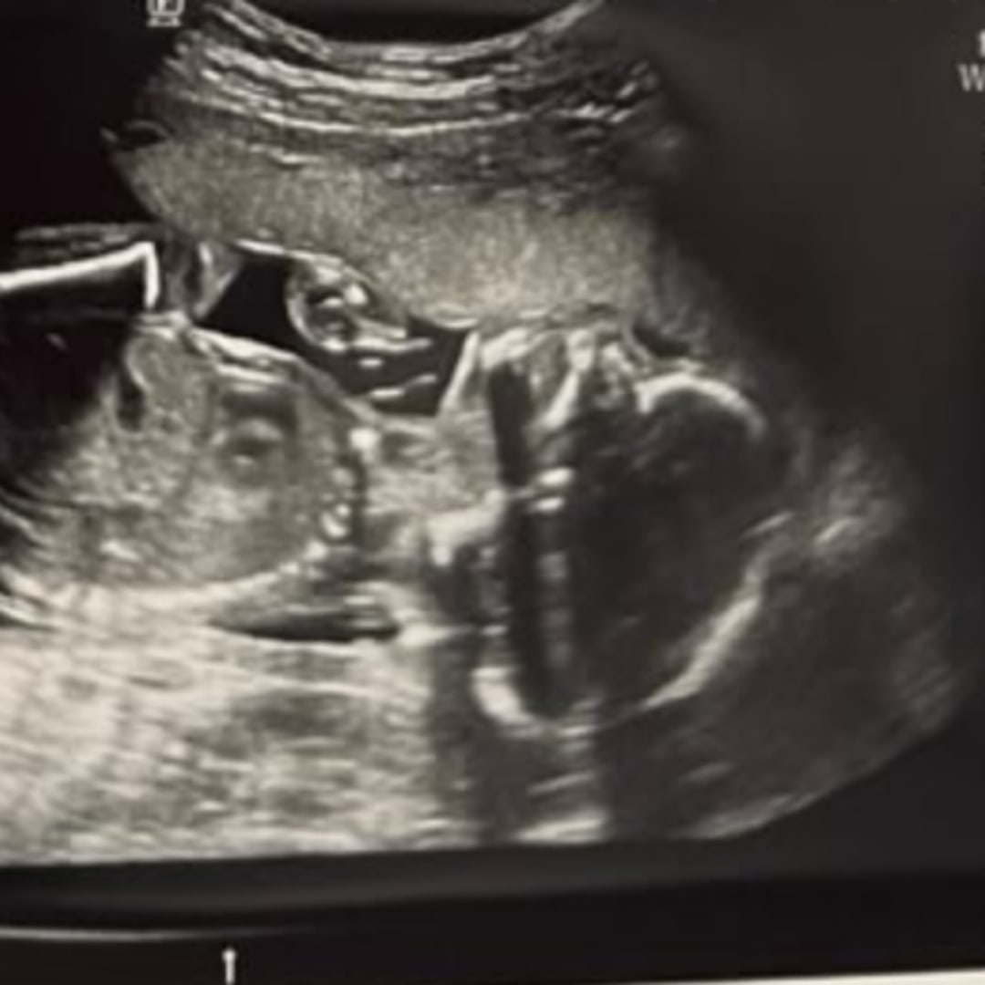 Photo shared by Annabelle for their Babylist baby registry.