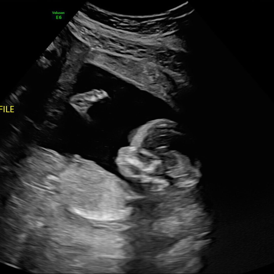 Photo shared by Amy for their Babylist baby registry.