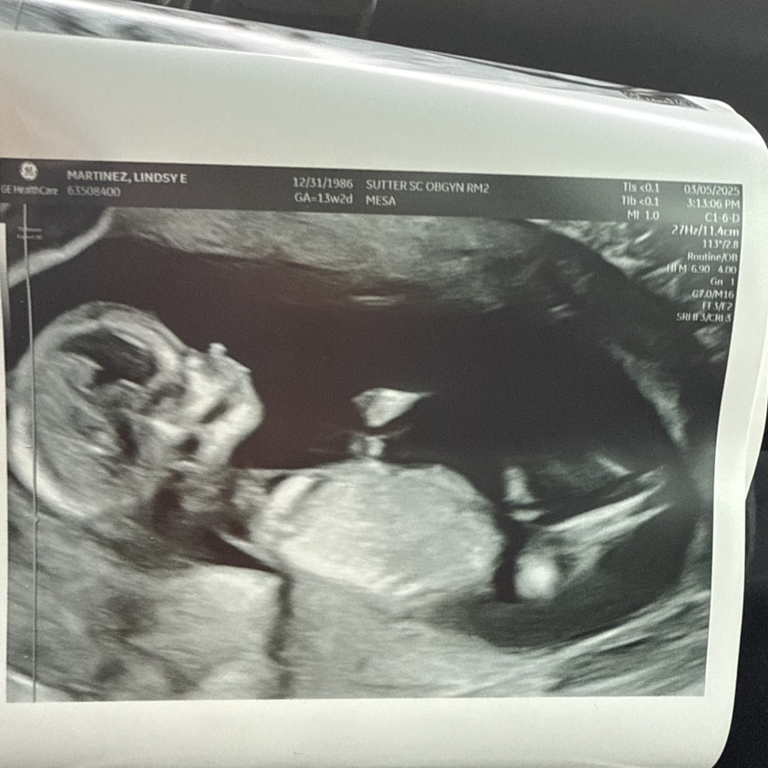 Photo shared by Lindsy for their Babylist baby registry.