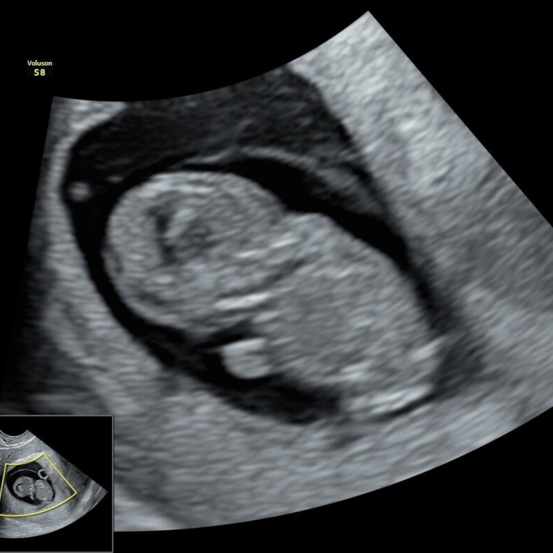 Photo shared by Emma for their Babylist baby registry.