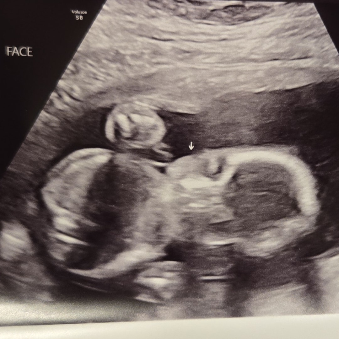 Photo shared by Bayli for their Babylist baby registry.