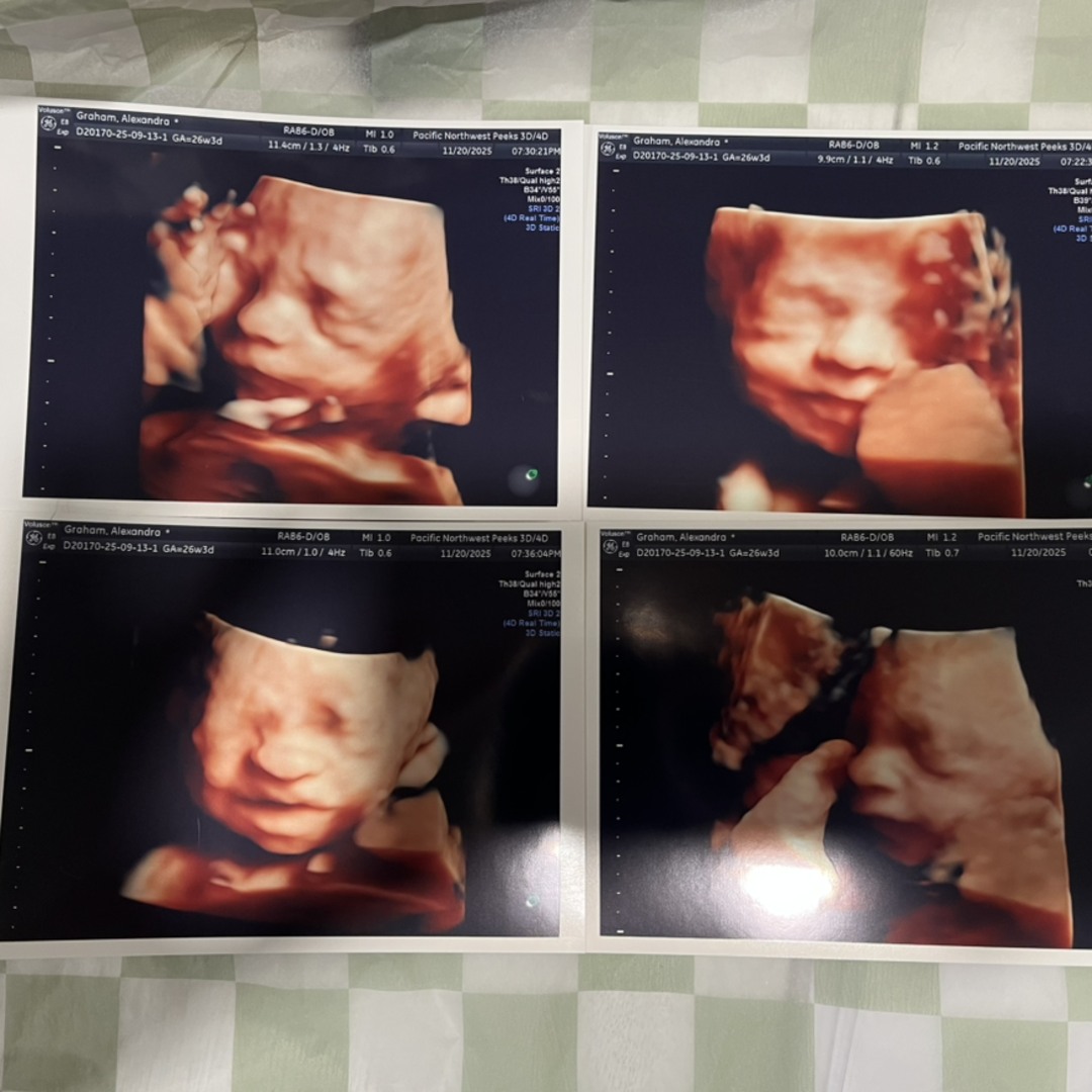 Photo shared by Ally for their Babylist baby registry.