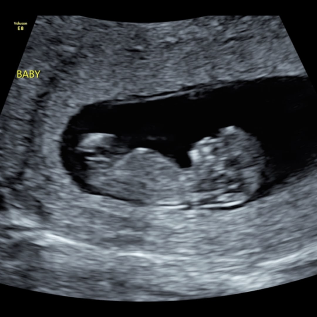 Photo shared by Autumn for their Babylist baby registry.