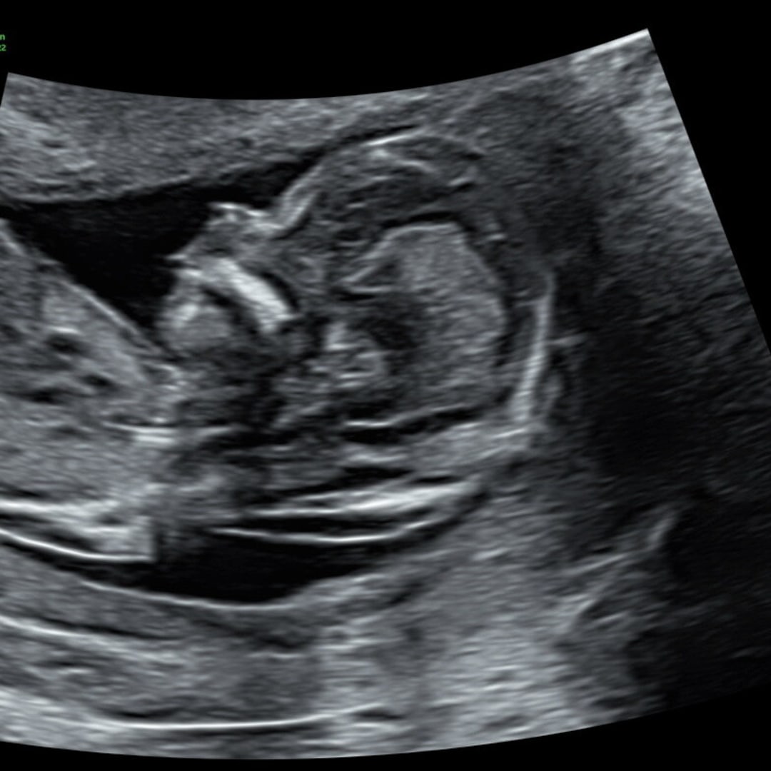 Photo shared by FarrahSymone for their Babylist baby registry.