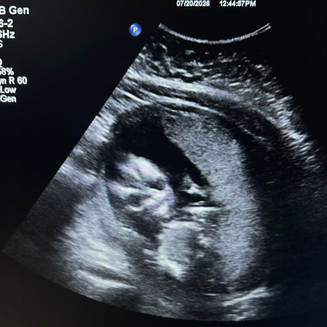 Photo shared by Valeria for their Babylist baby registry.