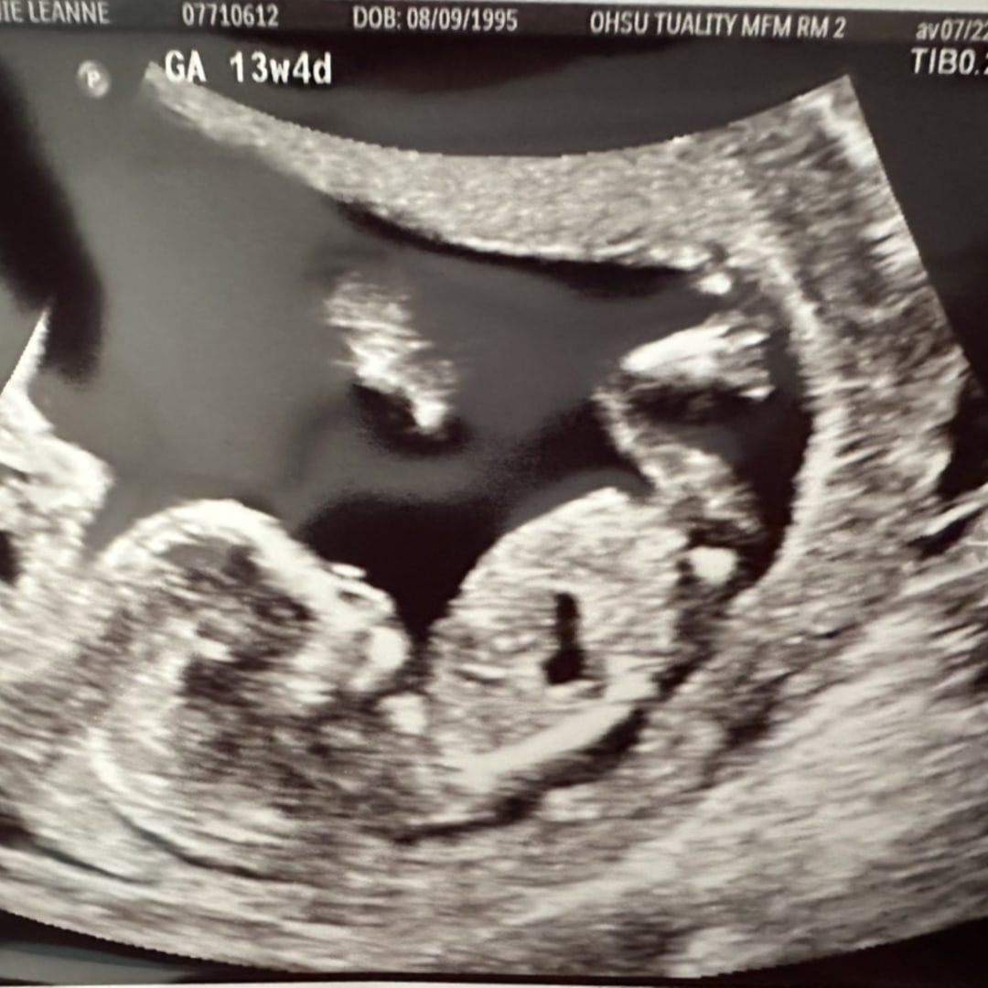 Photo shared by Stephanie for their Babylist baby registry.