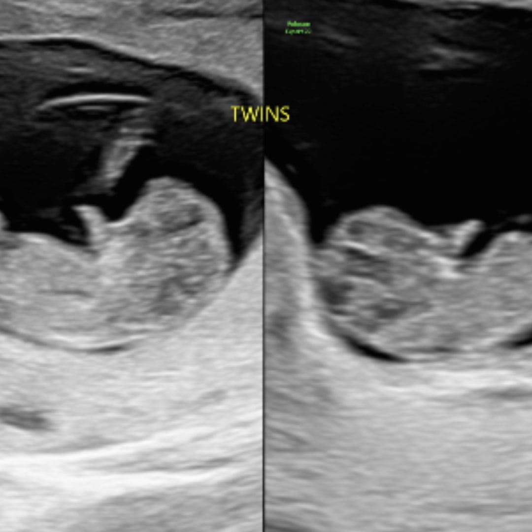 Photo shared by Christina for their Babylist baby registry.