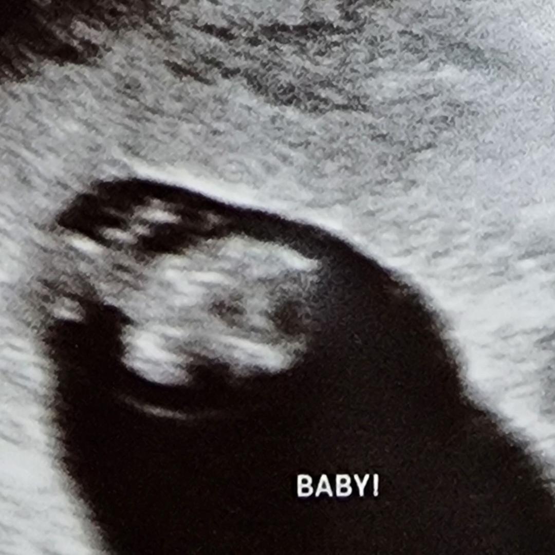 Photo shared by Elizabeth for their Babylist baby registry.