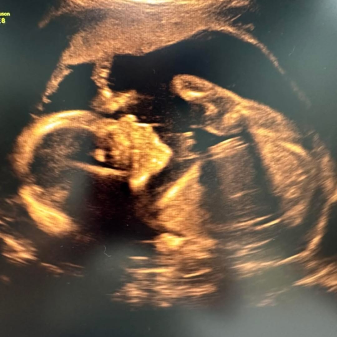 Photo shared by Courtney for their Babylist baby registry.