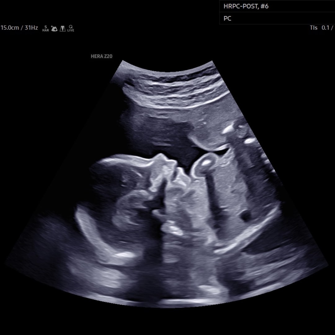 Photo shared by Chelsey for their Babylist baby registry.