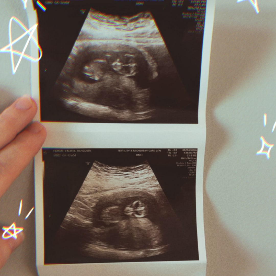 Photo shared by Calista for their Babylist baby registry.
