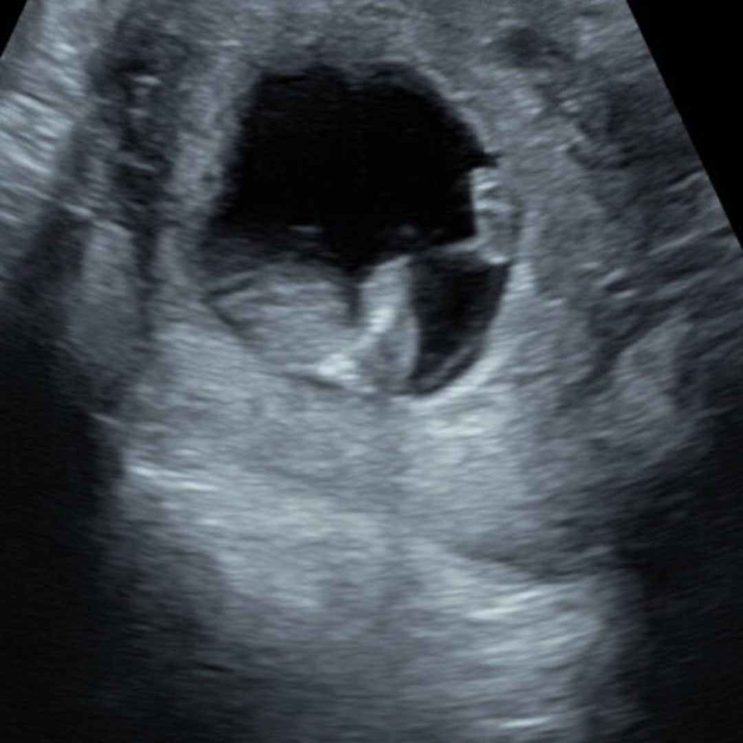 Photo shared by Natasha for their Babylist baby registry.