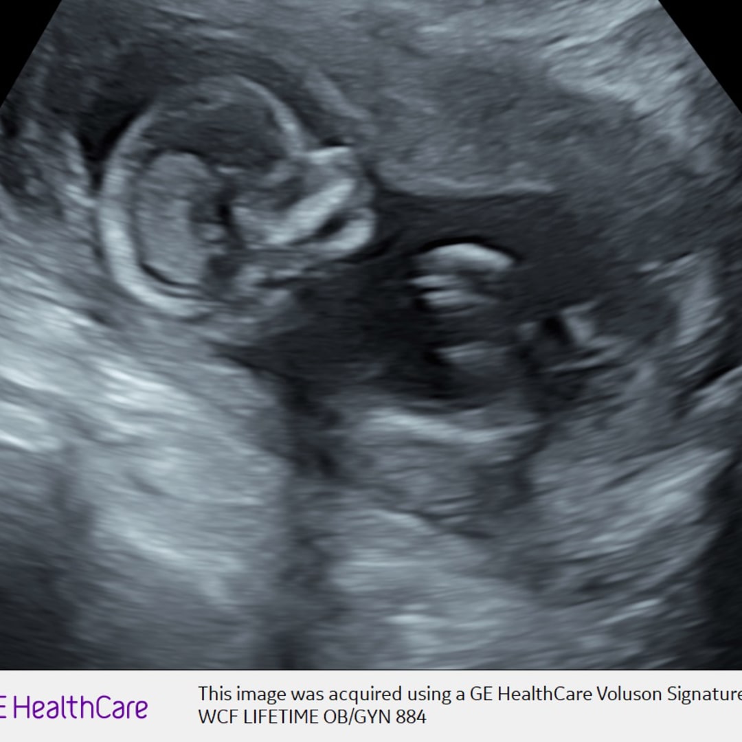 Photo shared by Emily for their Babylist baby registry.