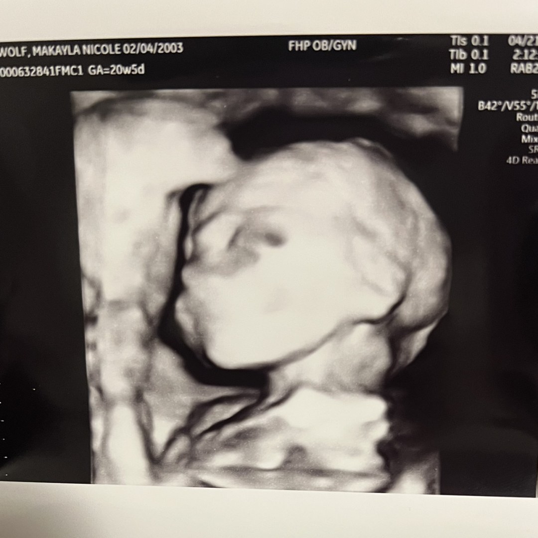 Photo shared by Makayla for their Babylist baby registry.