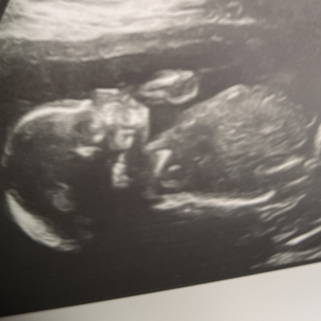 Photo shared by Vanecia for their Babylist baby registry.