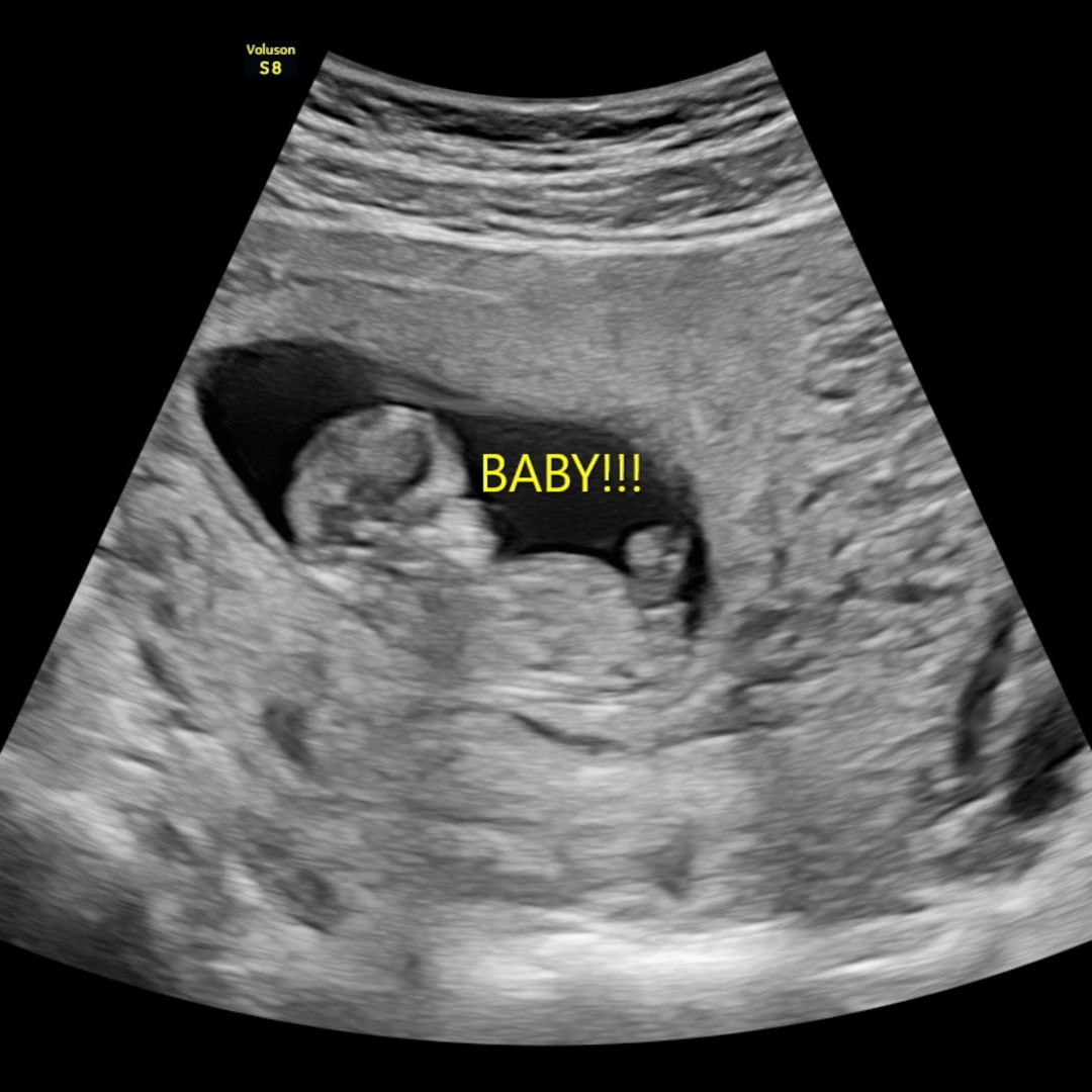 Photo shared by Madison for their Babylist baby registry.