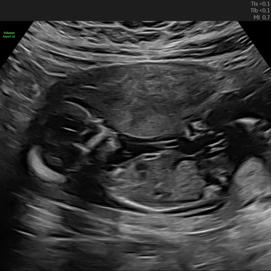 Photo shared by Krista for their Babylist baby registry.