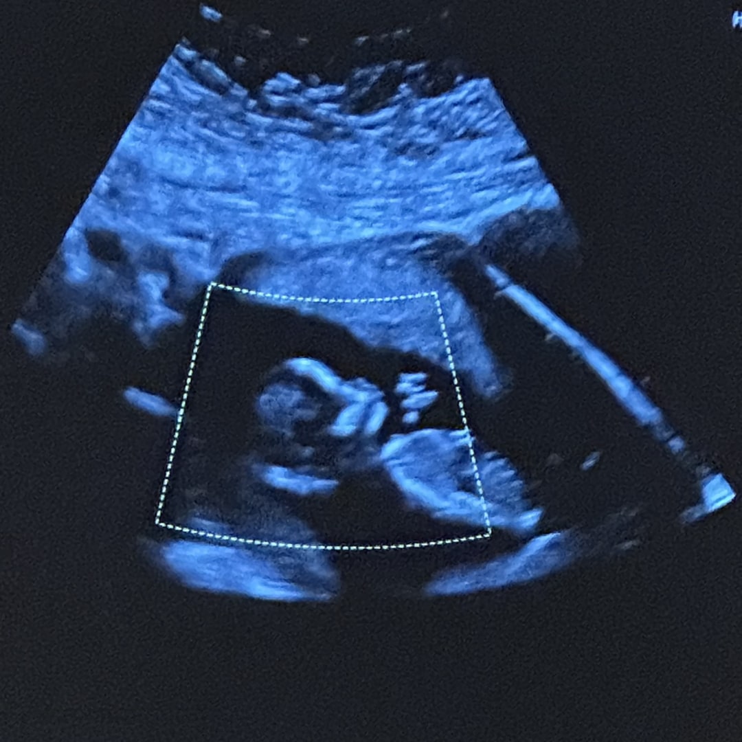 Photo shared by Lauren & Jake for their Babylist baby registry.