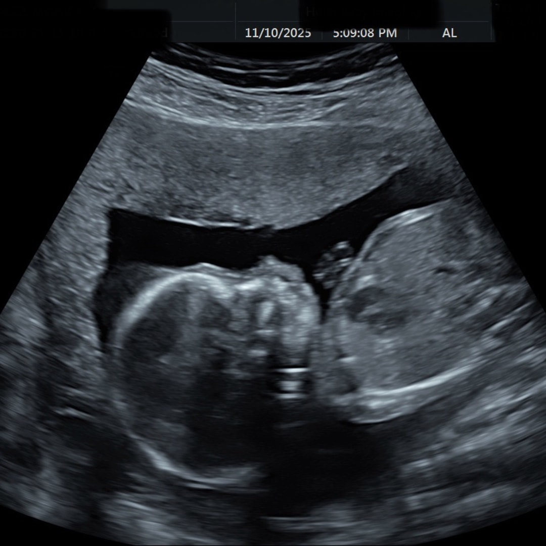 Photo shared by Monica for their Babylist baby registry.