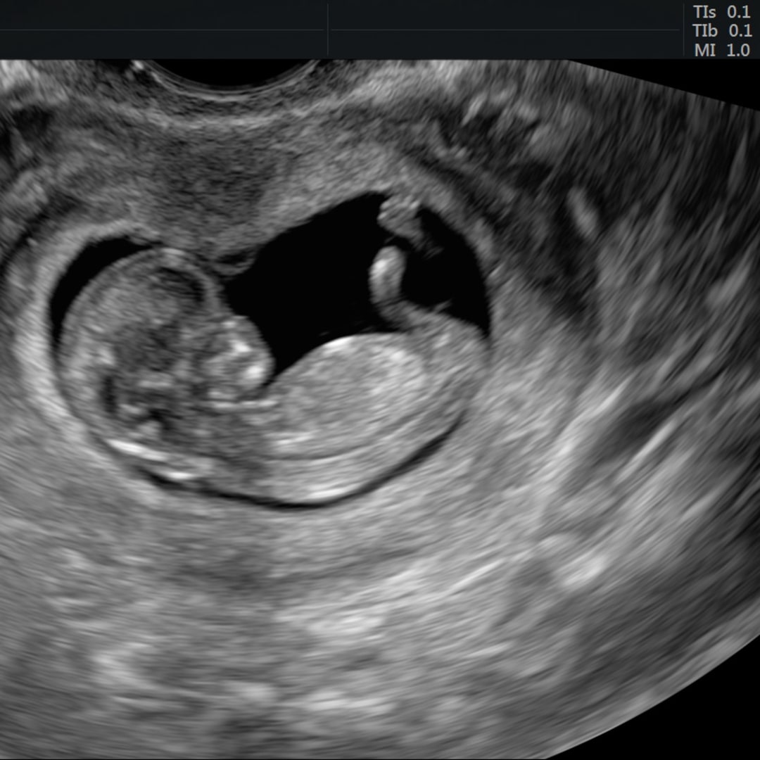Photo shared by Kelli for their Babylist baby registry.