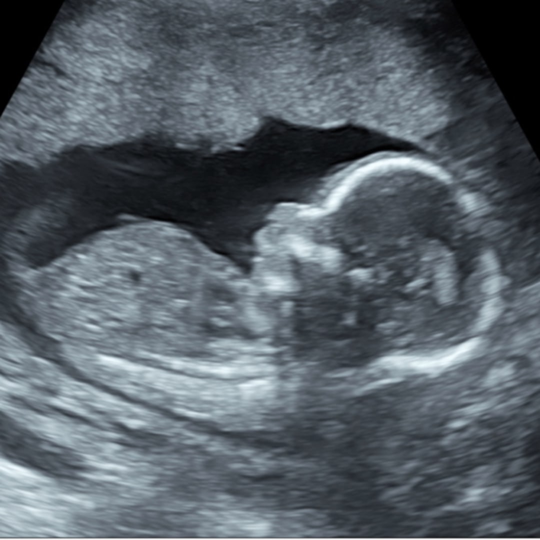Photo shared by Destiny for their Babylist baby registry.