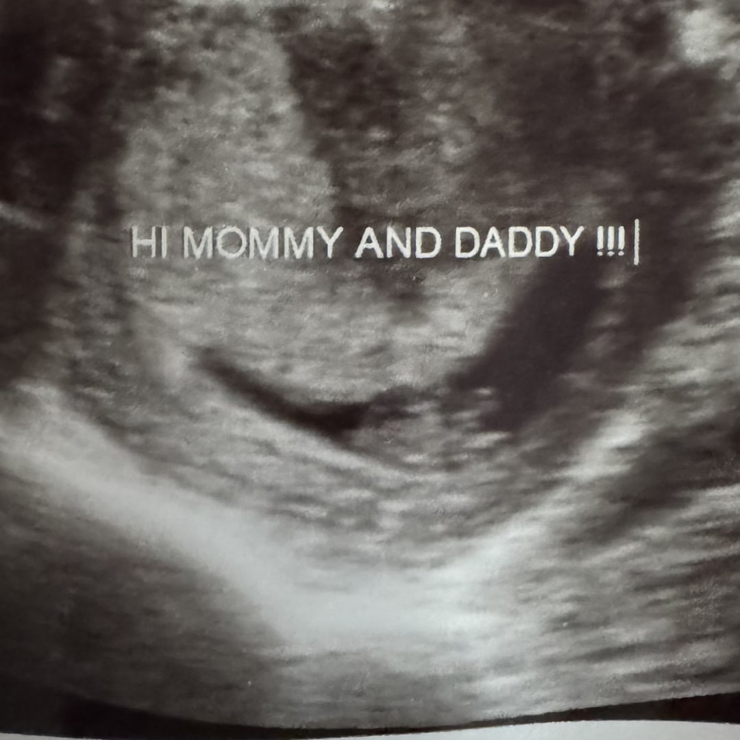 Photo shared by Alison for their Babylist baby registry.