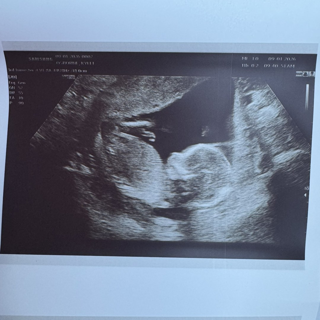 Photo shared by Kylee for their Babylist baby registry.