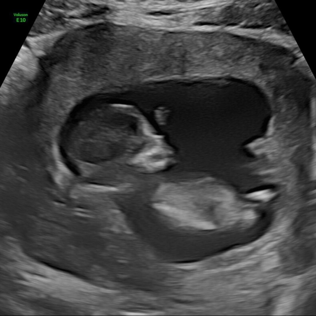 Photo shared by Ruchelle for their Babylist baby registry.