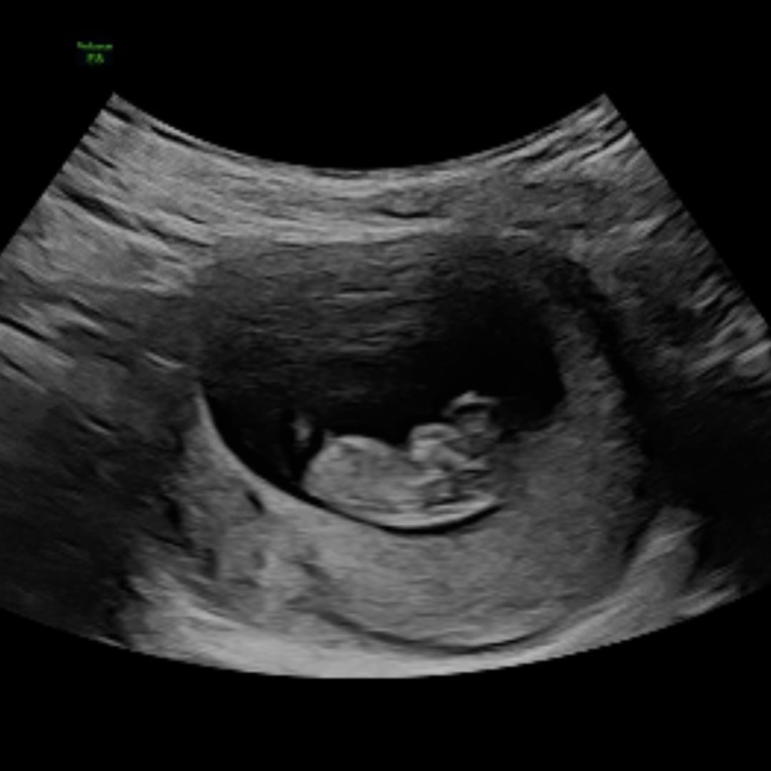 Photo shared by Bethany for their Babylist baby registry.