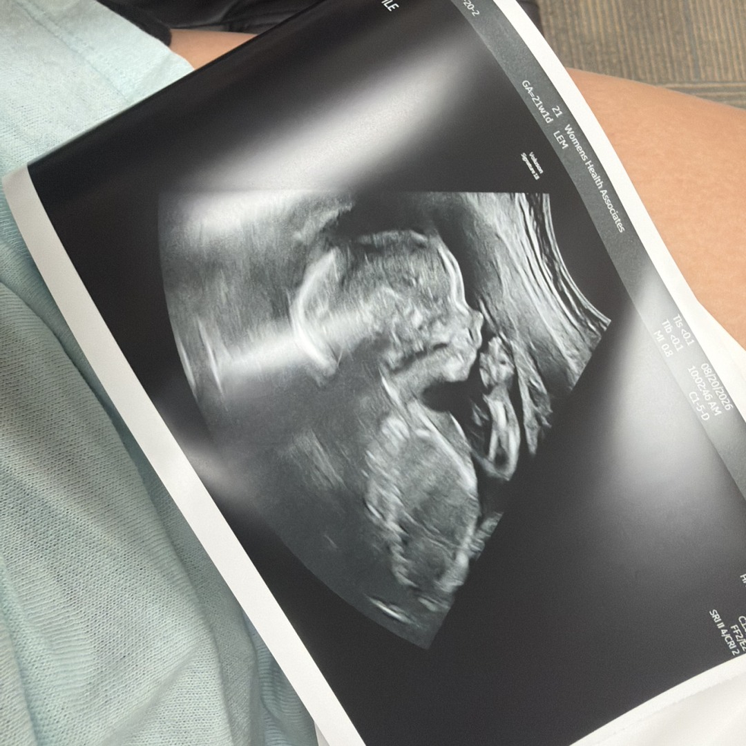 Photo shared by Emily for their Babylist baby registry.