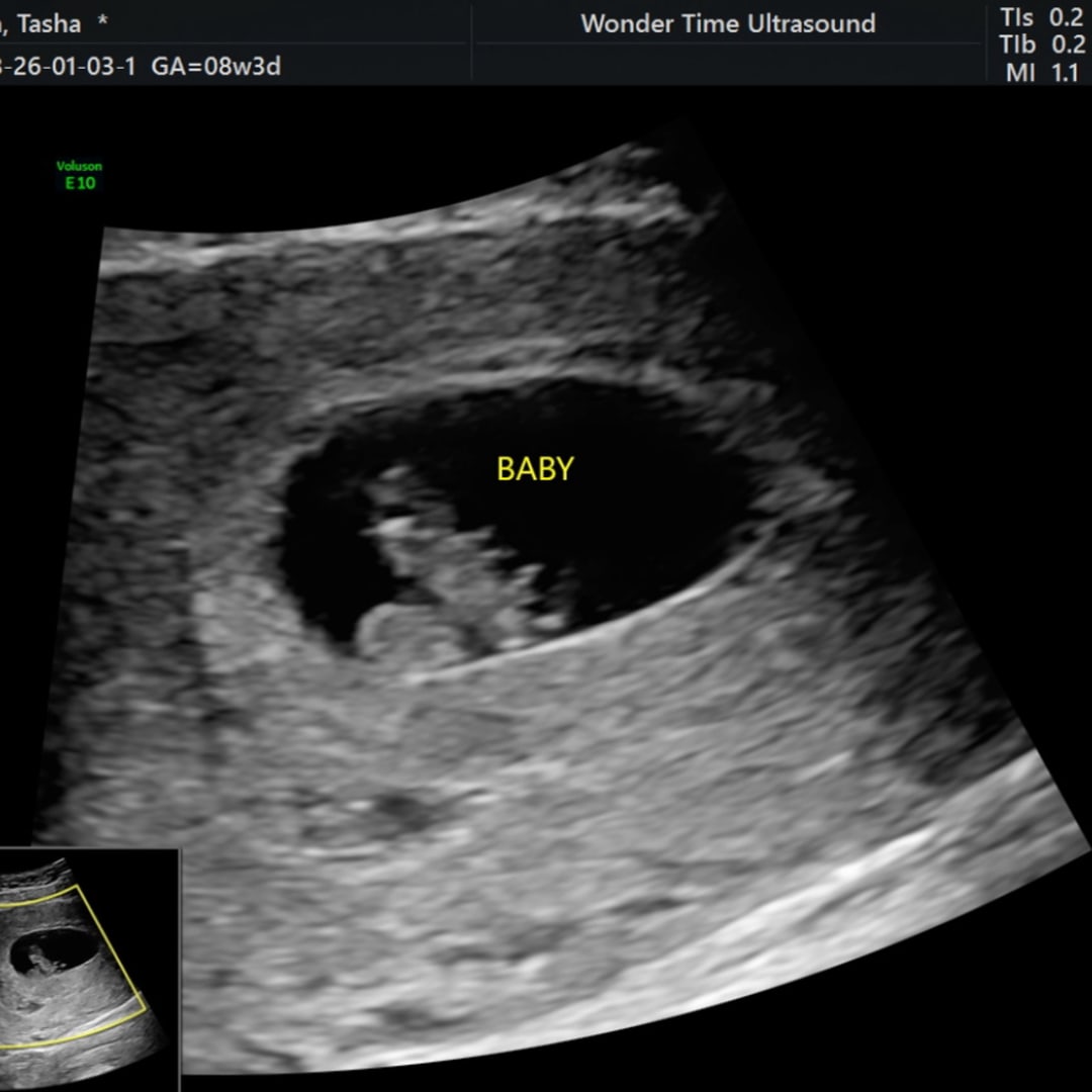 Photo shared by Tasha for their Babylist baby registry.