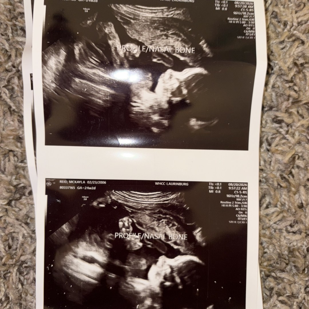 Photo shared by McKayla for their Babylist baby registry.