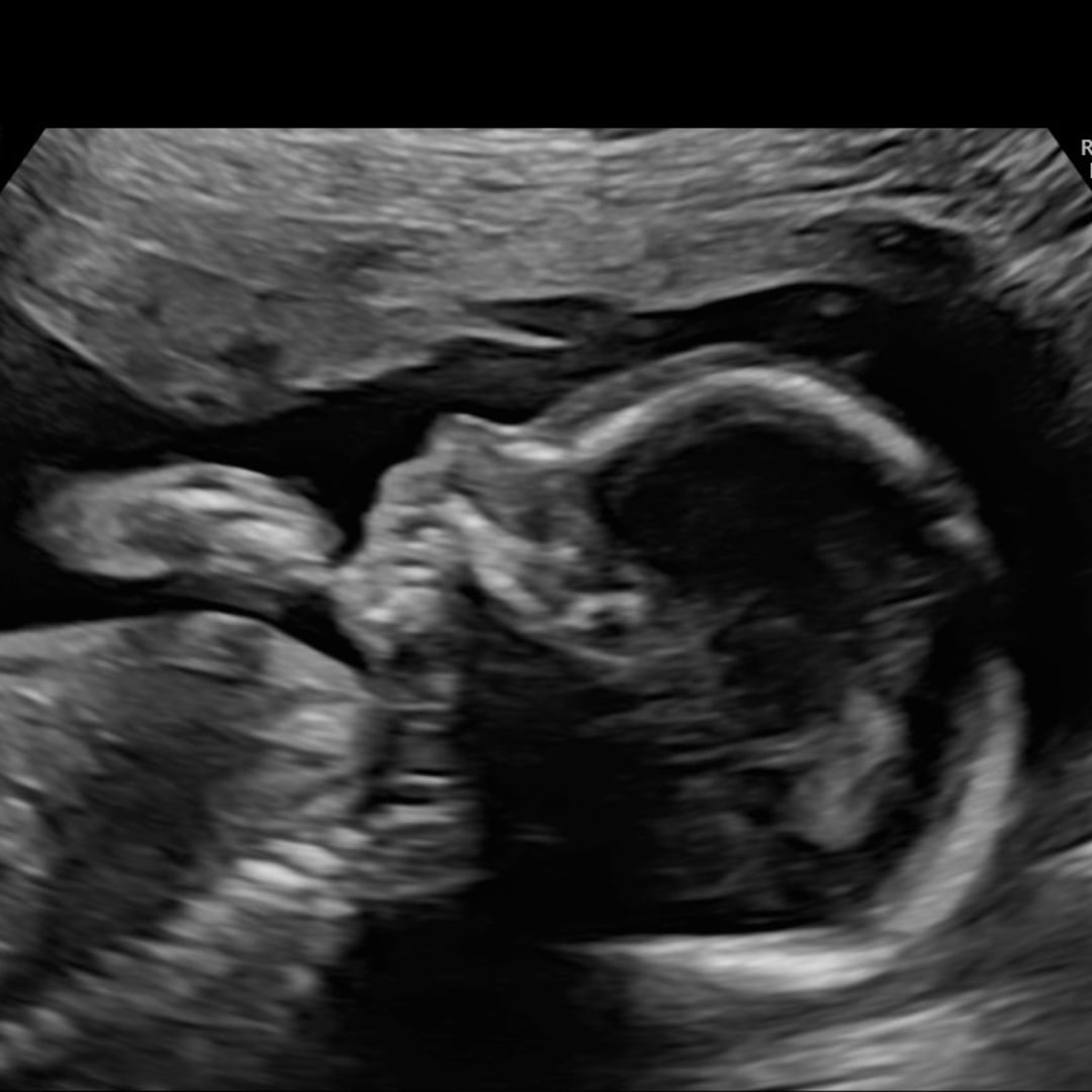 Photo shared by Kerin for their Babylist baby registry.