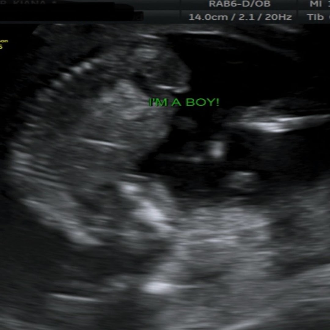 Photo shared by Cyan for their Babylist baby registry.