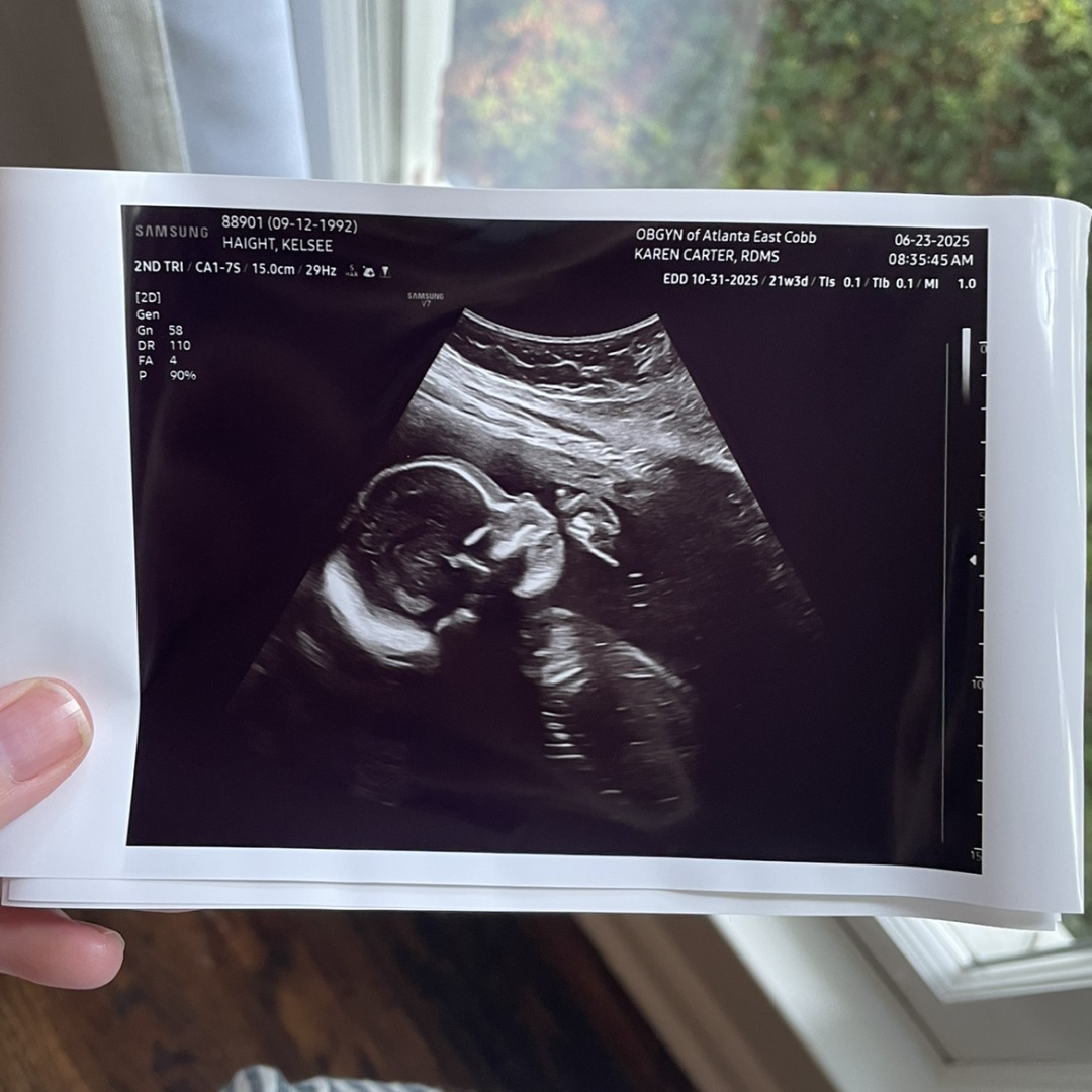 Photo shared by Kelsee for their Babylist baby registry.