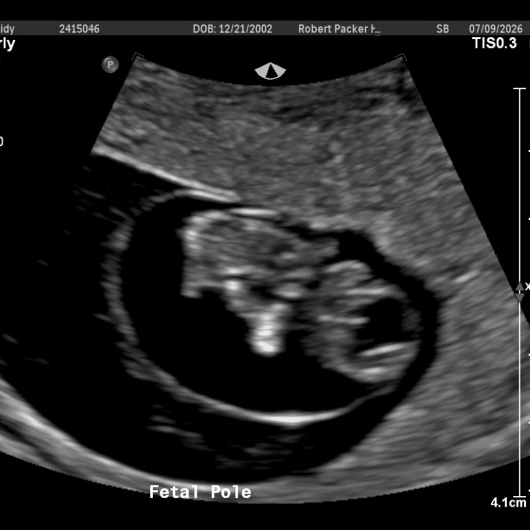 Photo shared by Cassie for their Babylist baby registry.