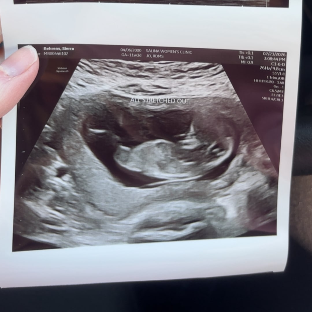 Photo shared by Sierra for their Babylist baby registry.