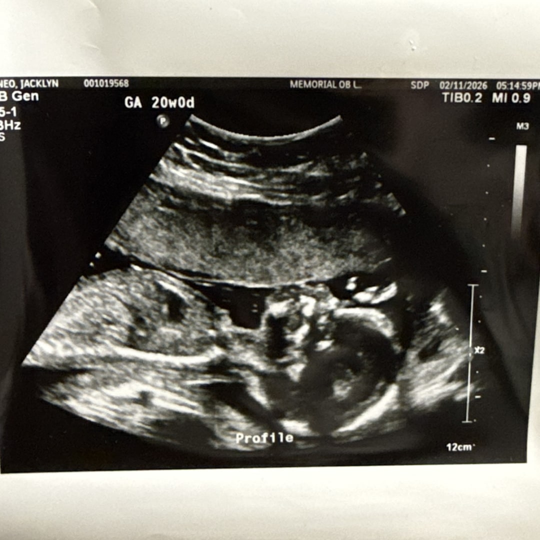 Photo shared by Jacklyn for their Babylist baby registry.